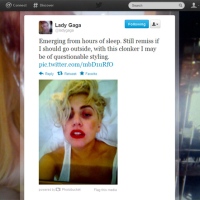 Lady Gaga Shows Off Black Eye After Accident With Dancer